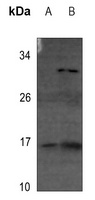 Anti-4EBP1 (Phospho-T69) Antibody