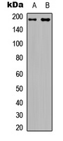 IRS1 (Phospho-S794) antibody