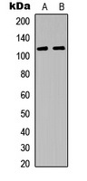 JAK3 antibody