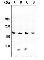 Anti-VEGFR2 Antibody