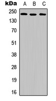 VEGFR2 (Phospho-Y951) antibody