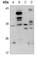 CD159a antibody