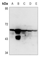 Cytokeratin 8 (Phospho-S432) antibody