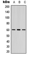 Anti-LYN (Phospho-Y397) Antibody