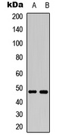 Anti-MKK7 (Phospho-S271) Antibody
