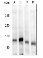 ASK1 (Phospho-S83) antibody