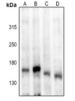 Anti-ASK1 (Phospho-S83) Antibody