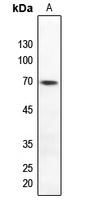Anti-TAK1 (Phospho-T184) Antibody