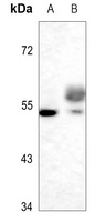 Tau antibody