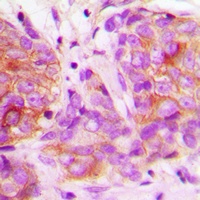 MARK2 Rabbit Polyclonal Antibody