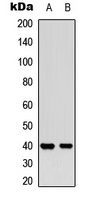 MCL1 (Phospho-S159) antibody