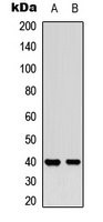 Anti-MCL1 (Phospho-S159) Antibody