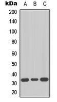 Anti-MKI67IP Antibody