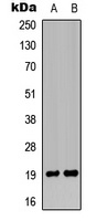 MRPL49 antibody