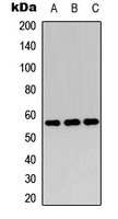Anti-c-Myc (Phospho-T358) Antibody