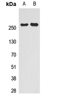 Anti-SMRT Antibody