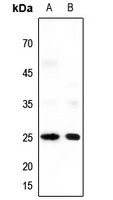 Anti-Neuromedin U Antibody