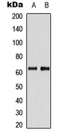 Anti-PDPK1 Antibody