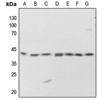 Anti-PKA C alpha/beta/gamma (Phospho-T198) Antibody