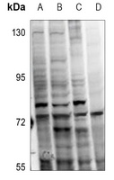 PKC alpha (Phospho-T638) antibody