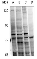 Anti-PKC alpha (Phospho-T638) Antibody