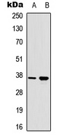 RAD51A (Phospho-Y315) antibody