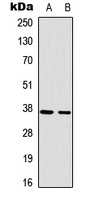 RAD51A antibody