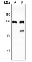 Anti-CTIP Antibody