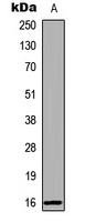Anti-RBP5 Antibody