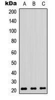 Anti-RhoA Antibody