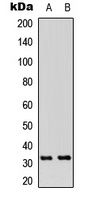 RPA2 (Phospho-T21) antibody