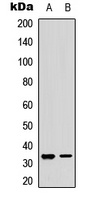 RPA2 (Phospho-S33) antibody