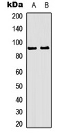 RSK1/2/3 (Phospho-T573/570/577) antibody
