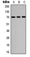 Anti-S6K1 (Phospho-T229) Antibody