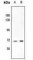 S6K1 (Phospho-T412) antibody