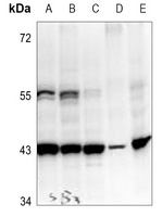 Anti-PEDF Antibody