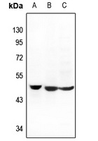 Anti-MCT14 Antibody