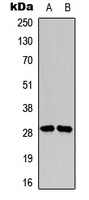 SNAI1/2 (Phospho-S246) antibody