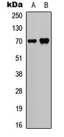 SPHK2 (Phospho-T614) antibody