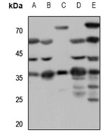 SSTR1 antibody