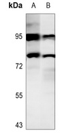 STAT4 (Phospho-Y693) antibody