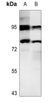 Anti-STAT4 (Phospho-Y693) Antibody