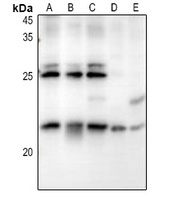 Anti-RB3 Antibody