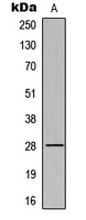 cTnI (Phospho-S43) antibody