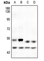 Anti-p53 (Phospho-S6) Antibody