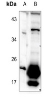 Anti-TUSC5 Antibody