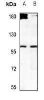 USP38 antibody