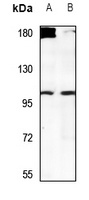 Anti-USP38 Antibody