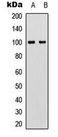 Anti-VAV2 (Phospho-Y142) Antibody