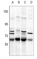 Anti-NIPA Antibody
